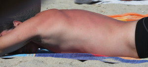 sunburnt man sunbathing